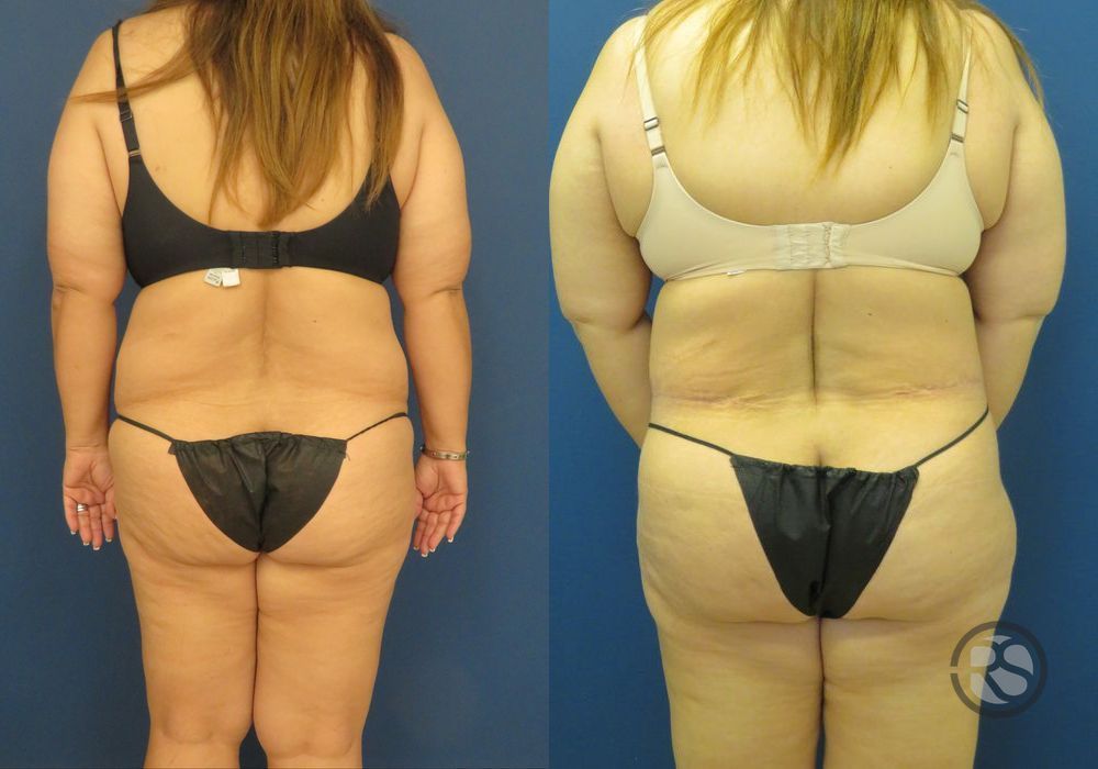 Before photo - Angle 6