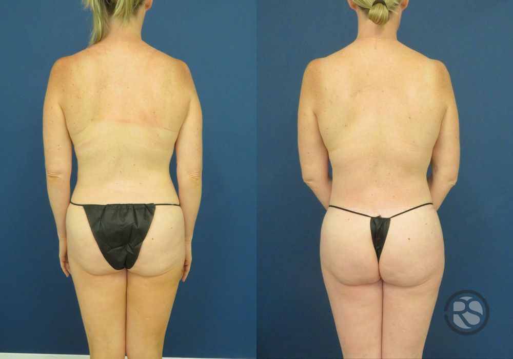 Before photo - Angle 6