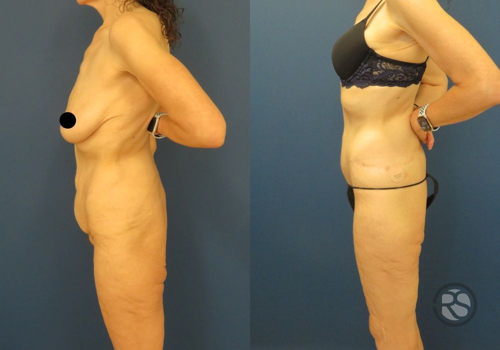 Before photo - Angle 5