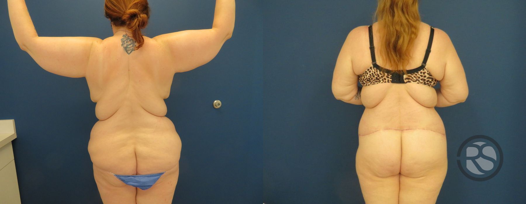 Before photo - Angle 6