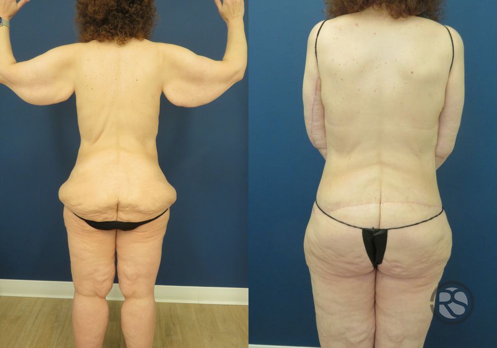 Before photo - Angle 2