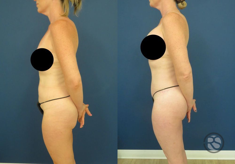 Before photo - Angle 5