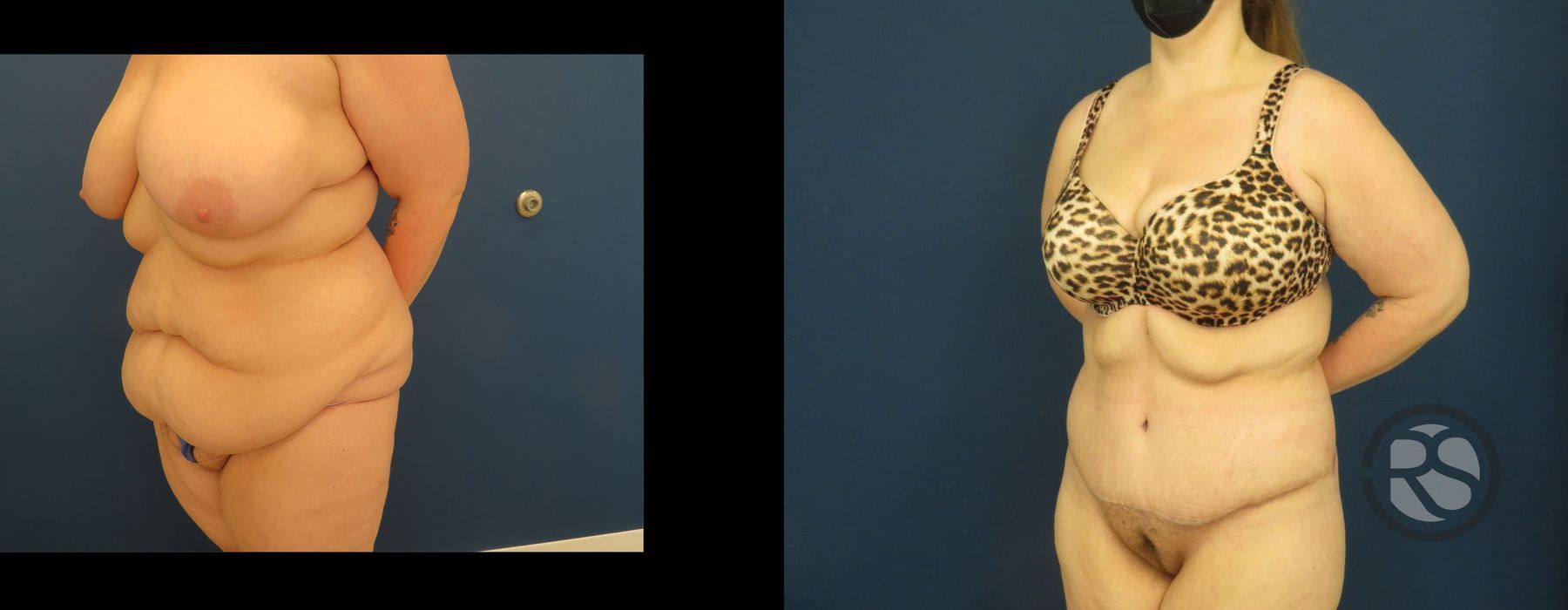 Before photo - Angle 4