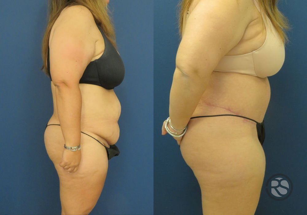 Before photo - Angle 3