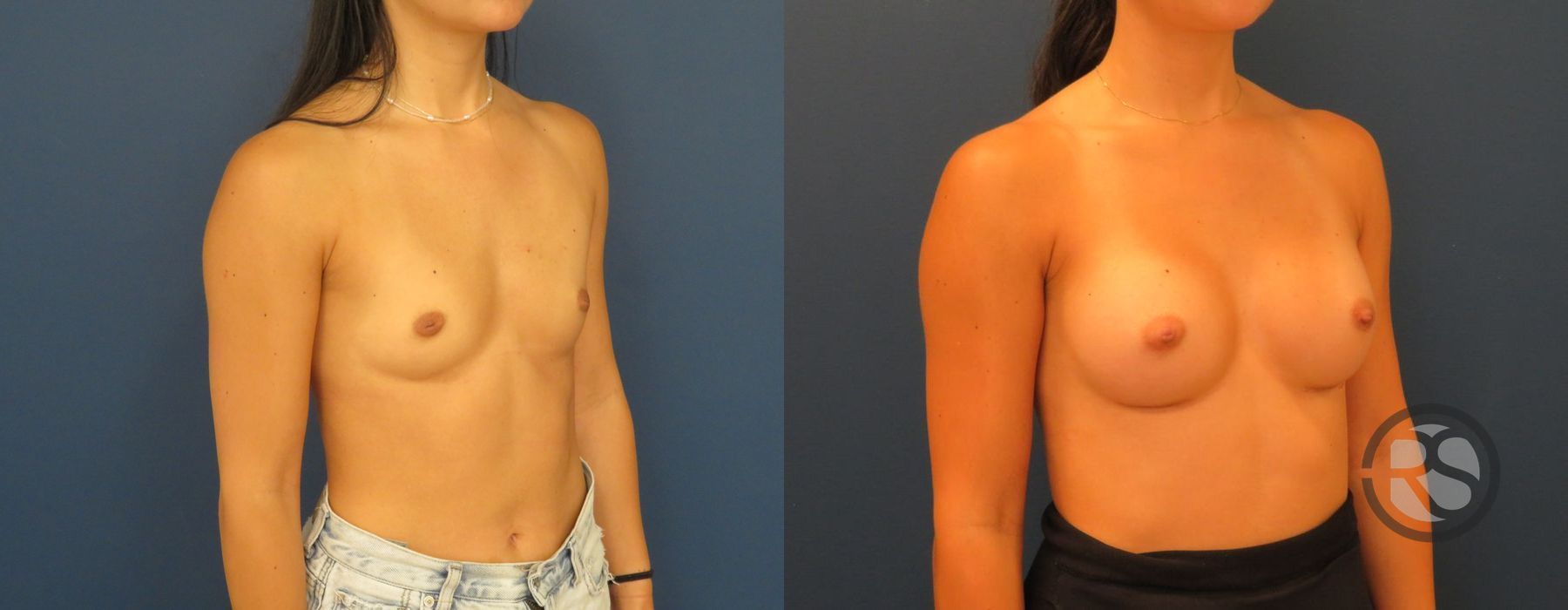 Before photo - Angle 3