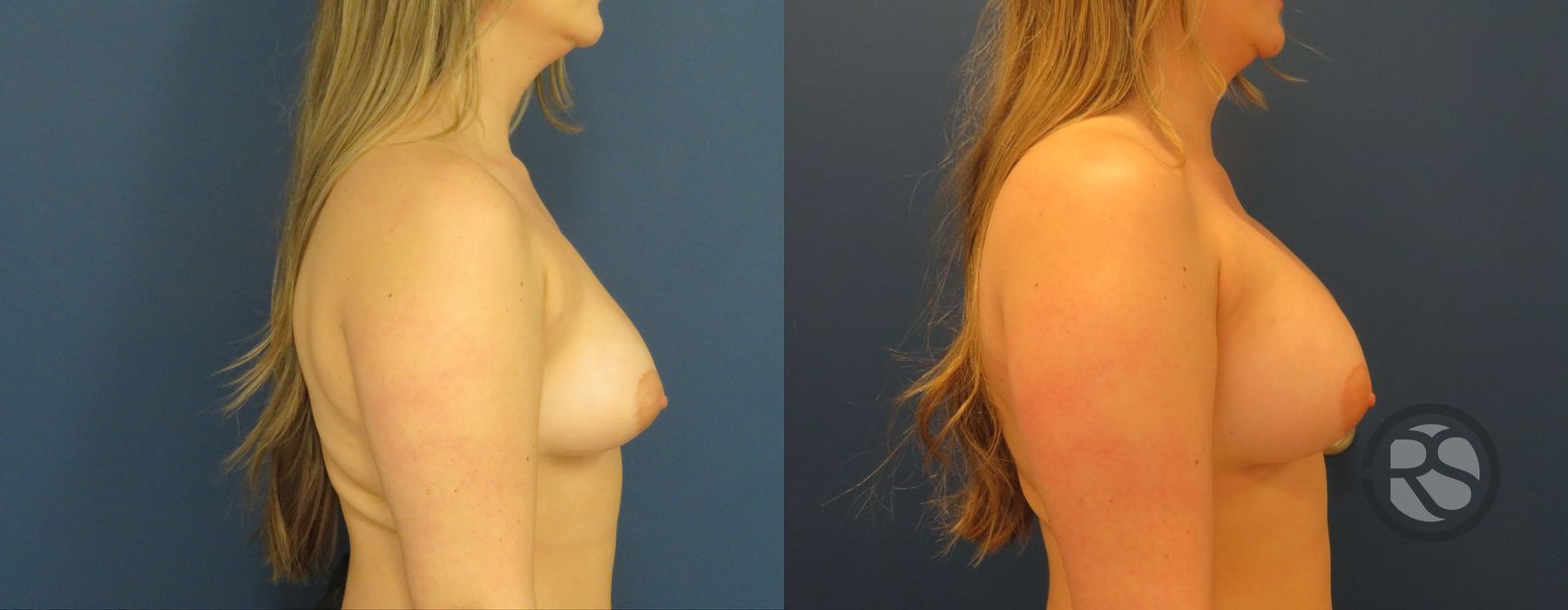 Before photo - Angle 5