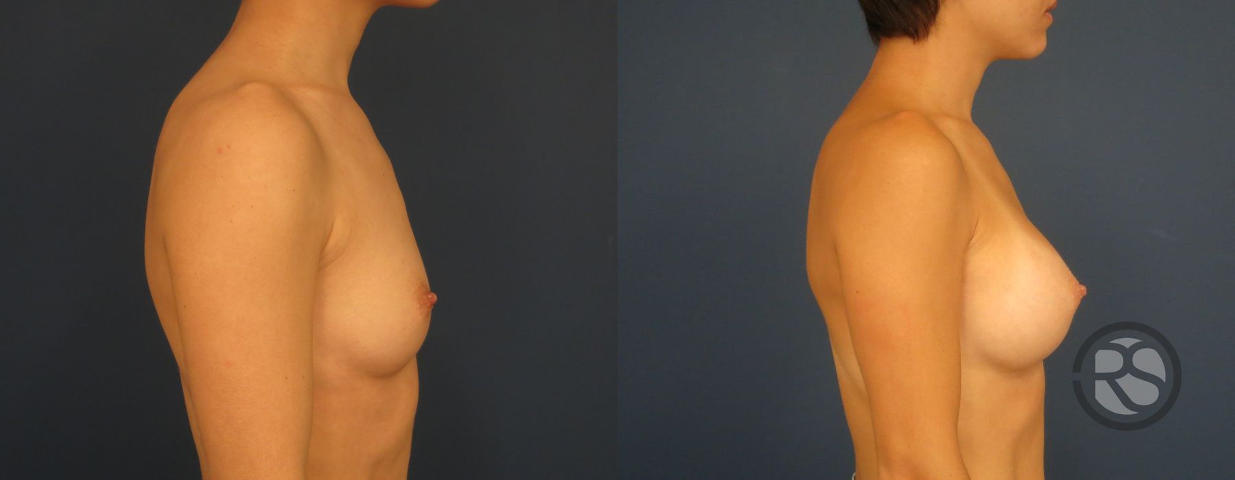 Before photo - Angle 5