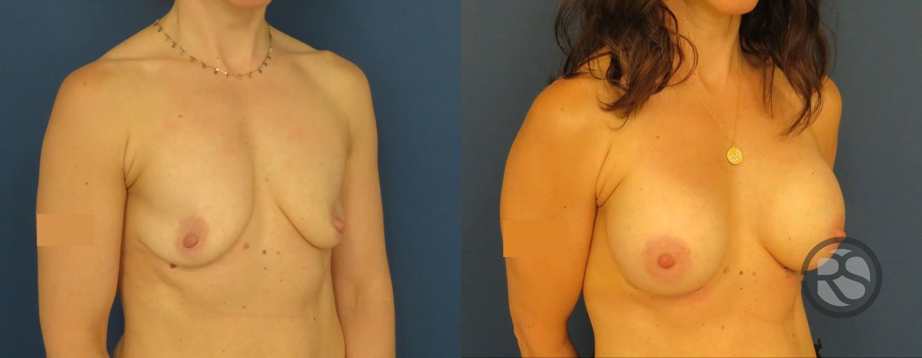 Before photo - Angle 2