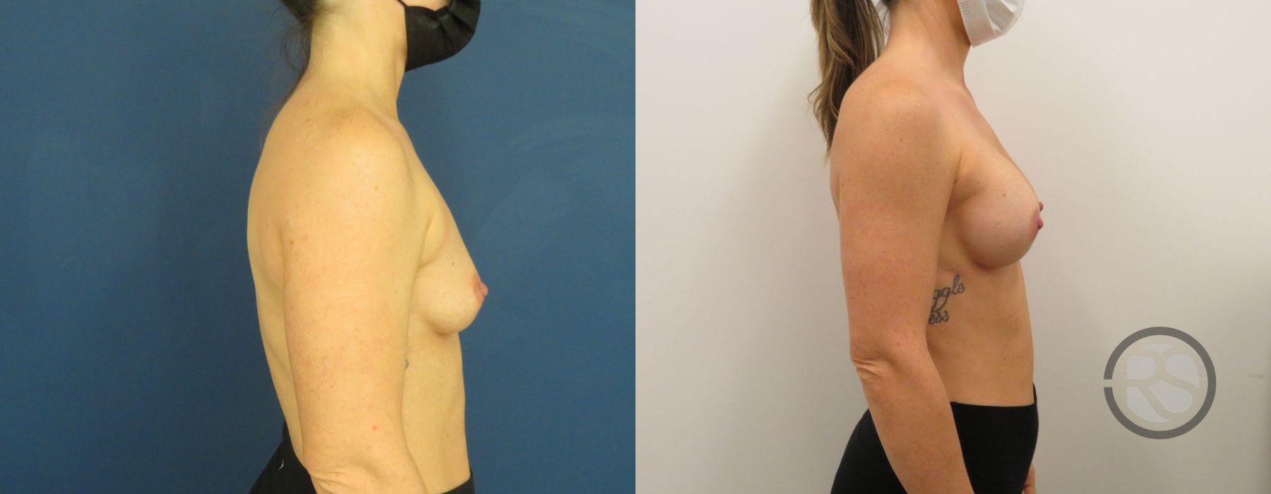 Before photo - Angle 3