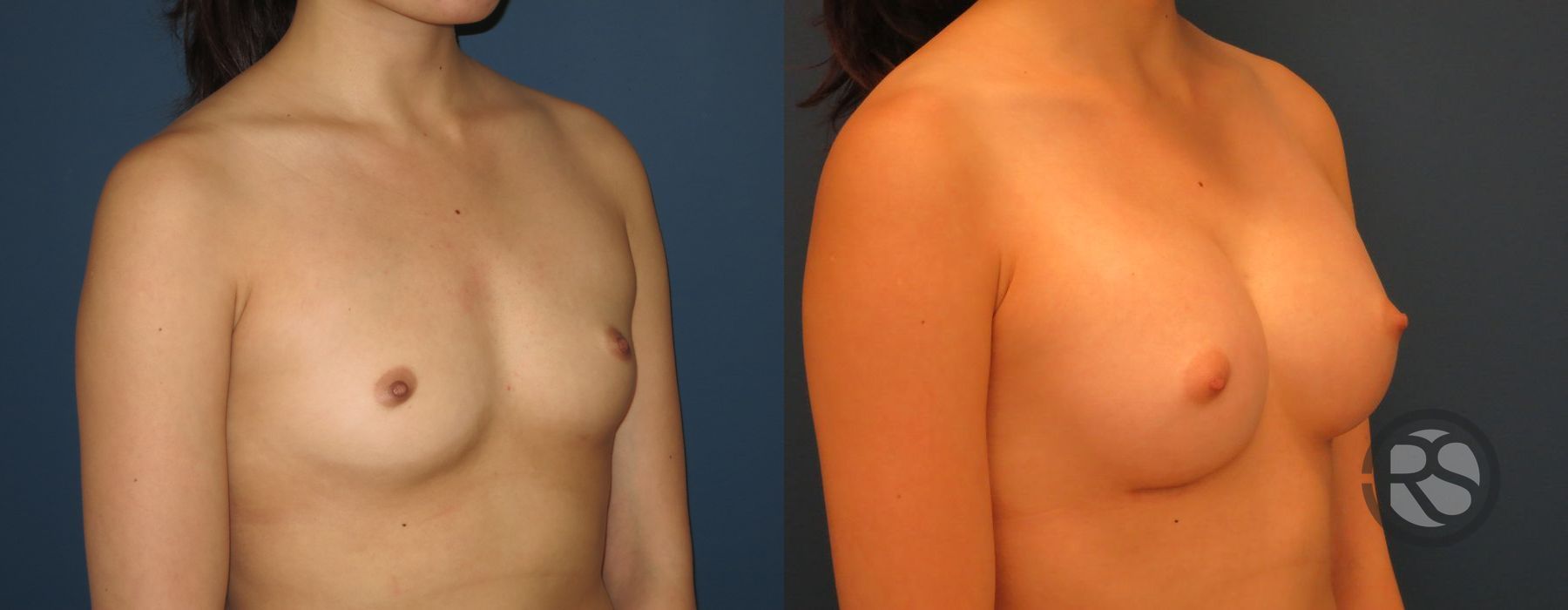 Before photo - Angle 2