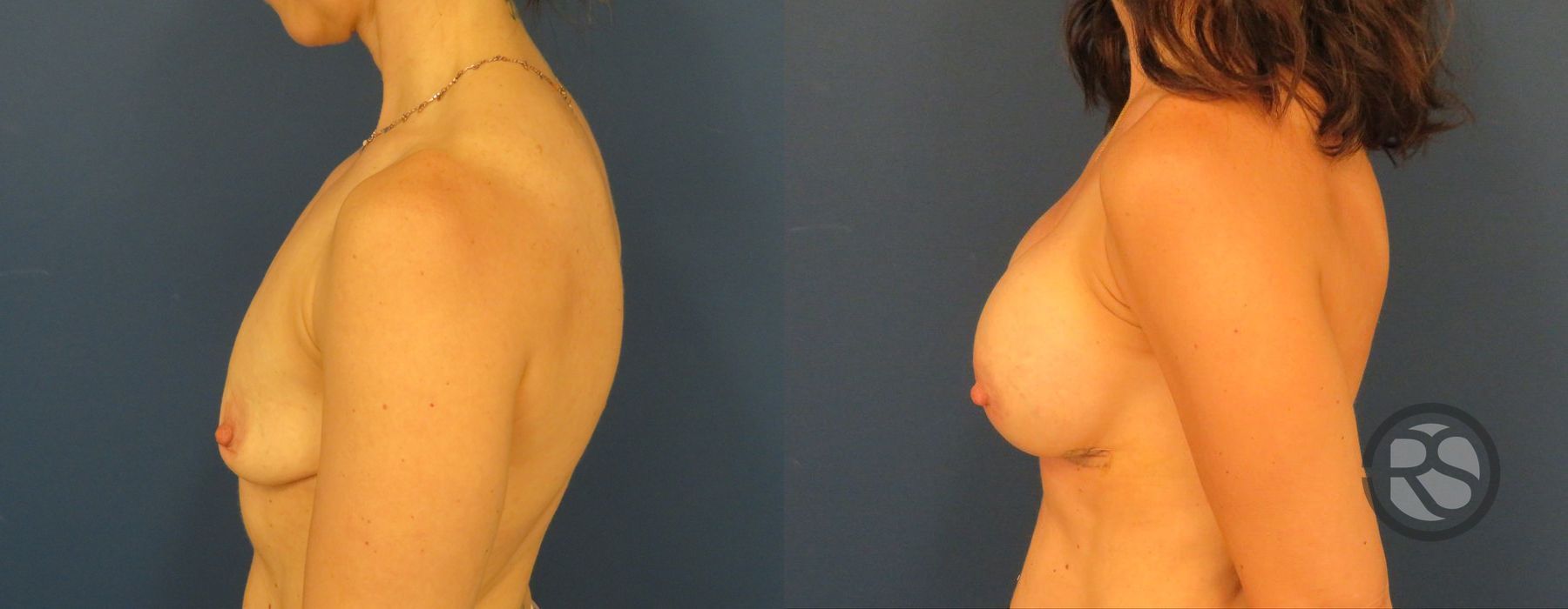 Before photo - Angle 5