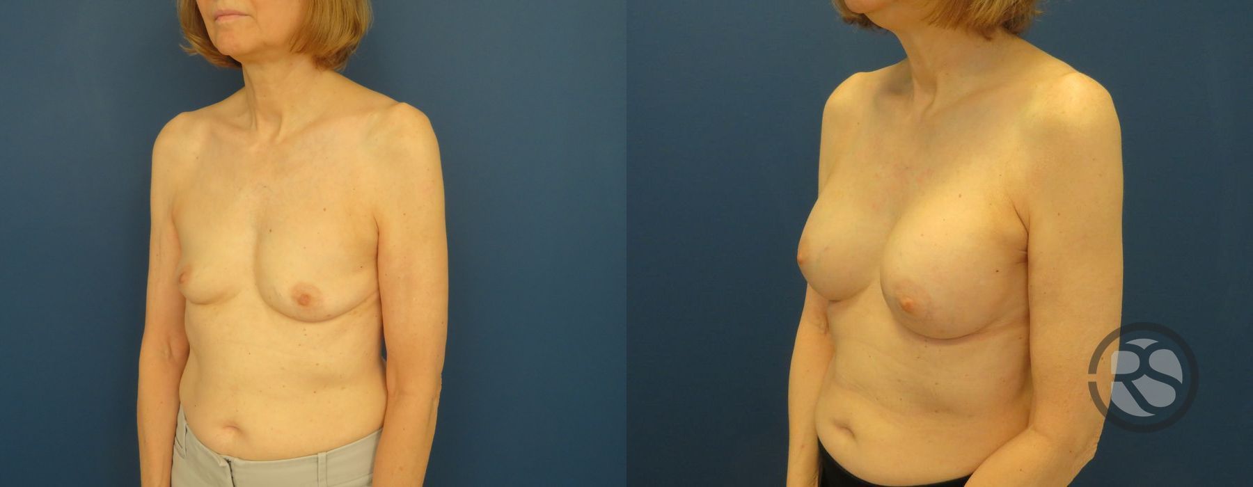 Before photo - Angle 2