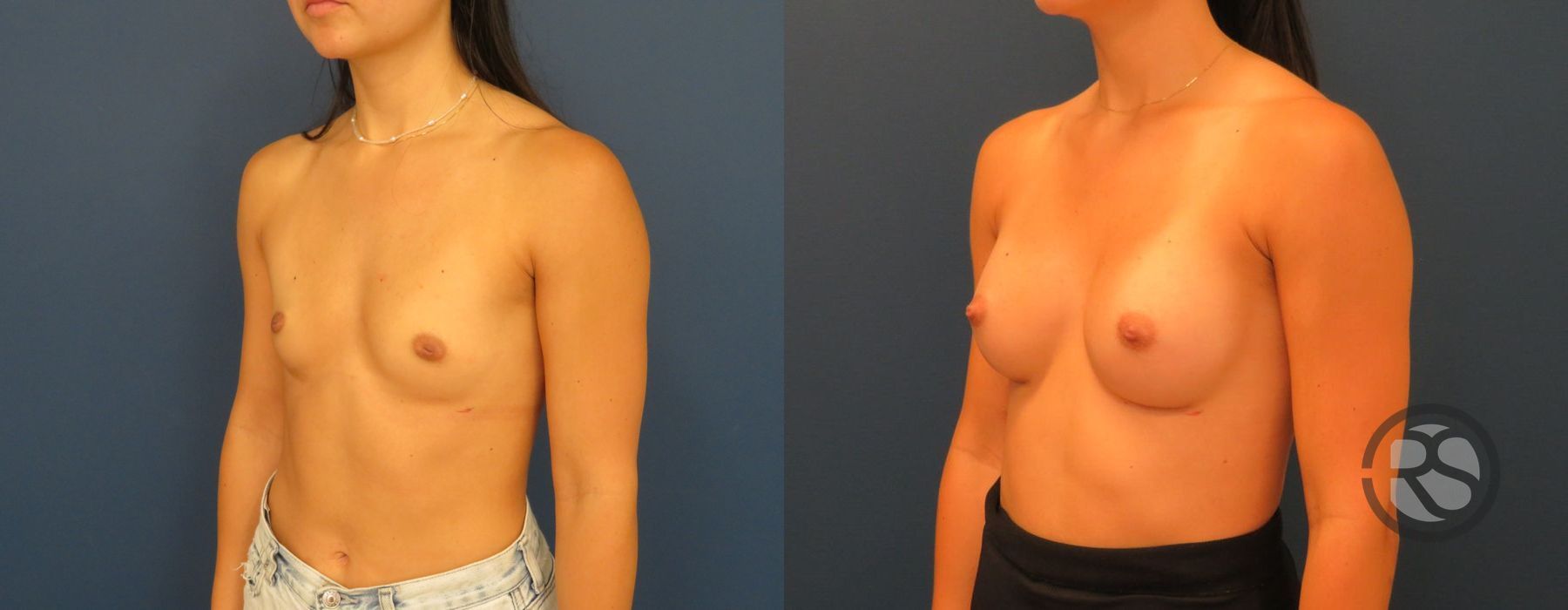 Before photo - Angle 2