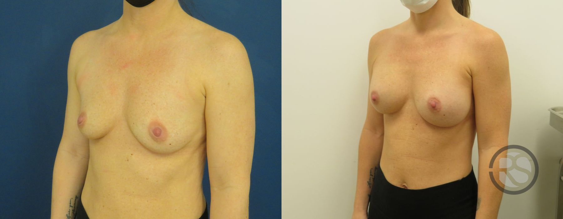 Before photo - Angle 4