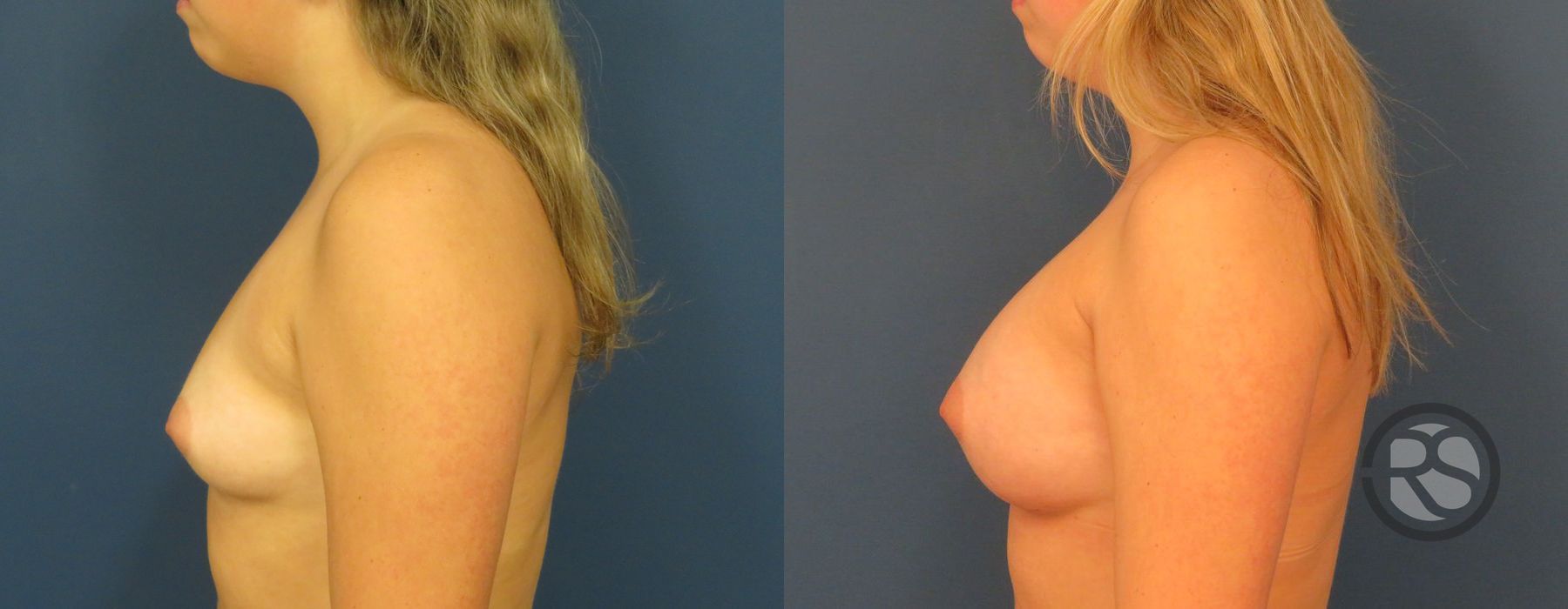 Before photo - Angle 5