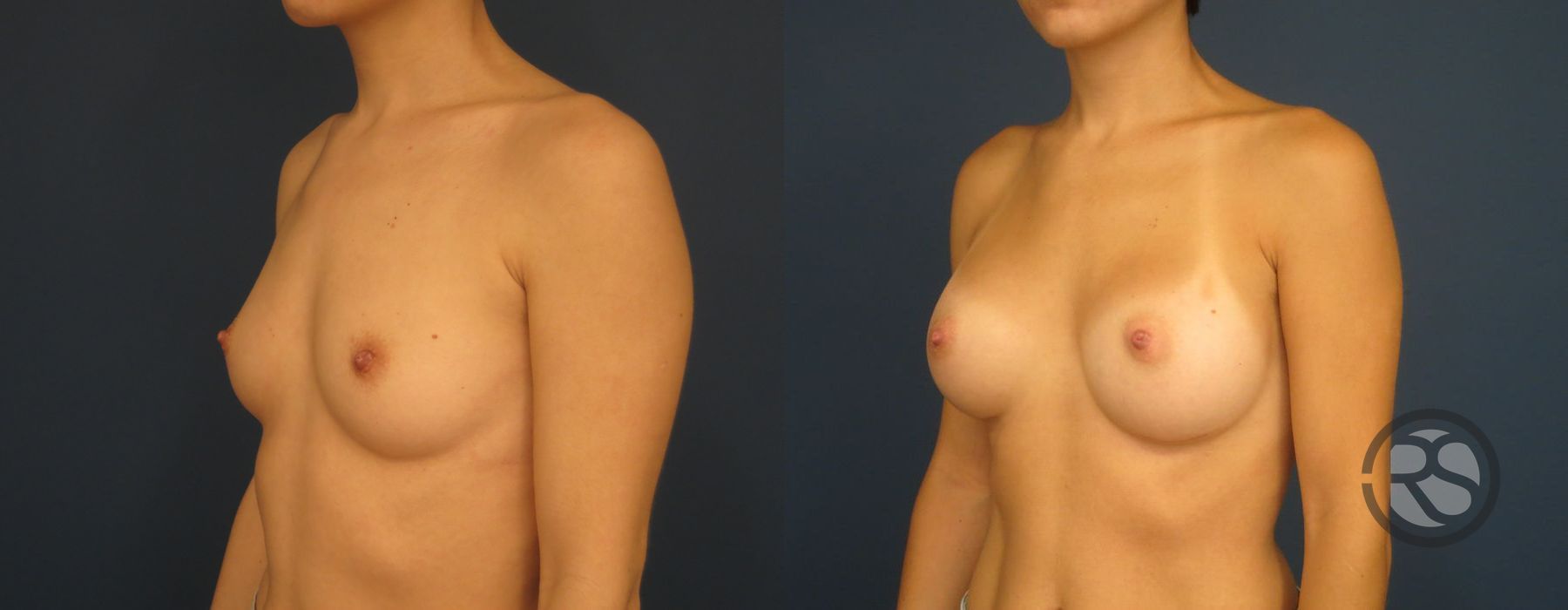 Before photo - Angle 2