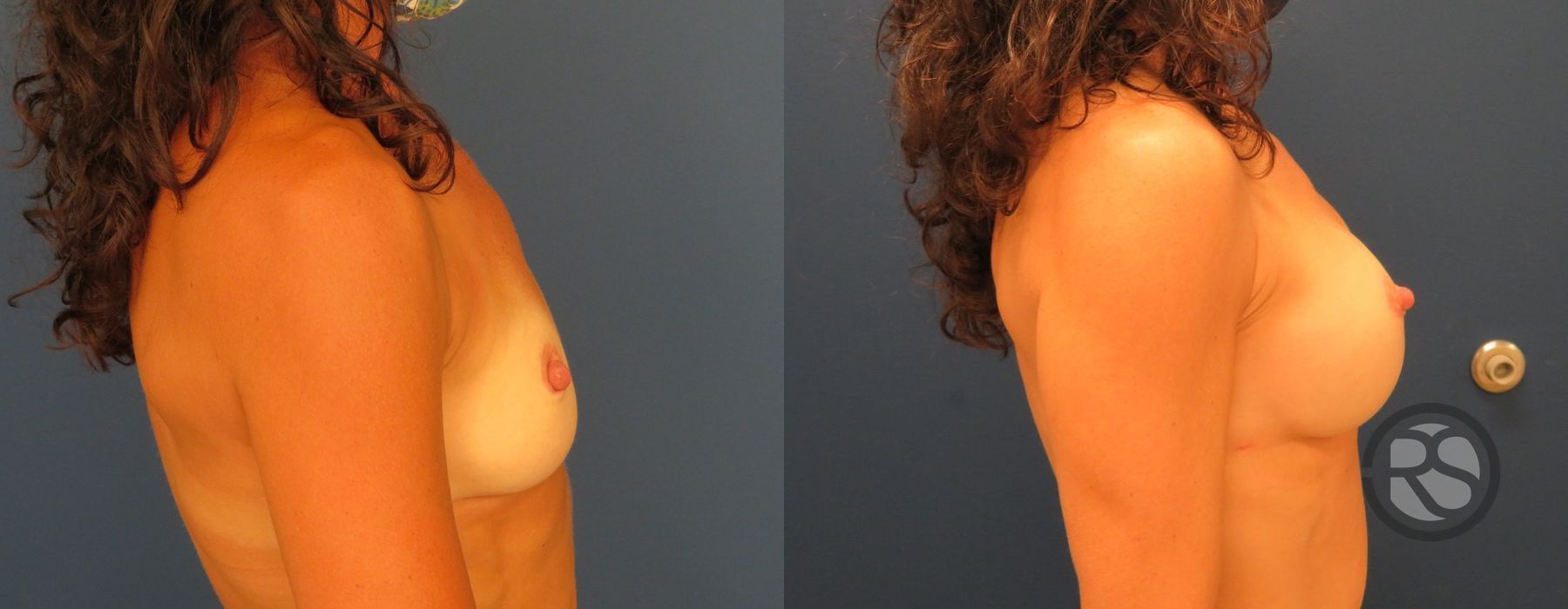 Before photo - Angle 3