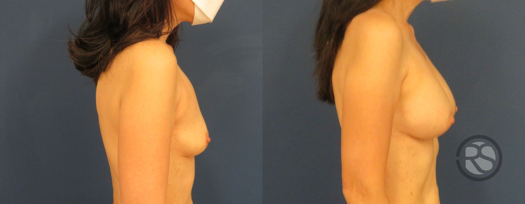 Before photo - Angle 5