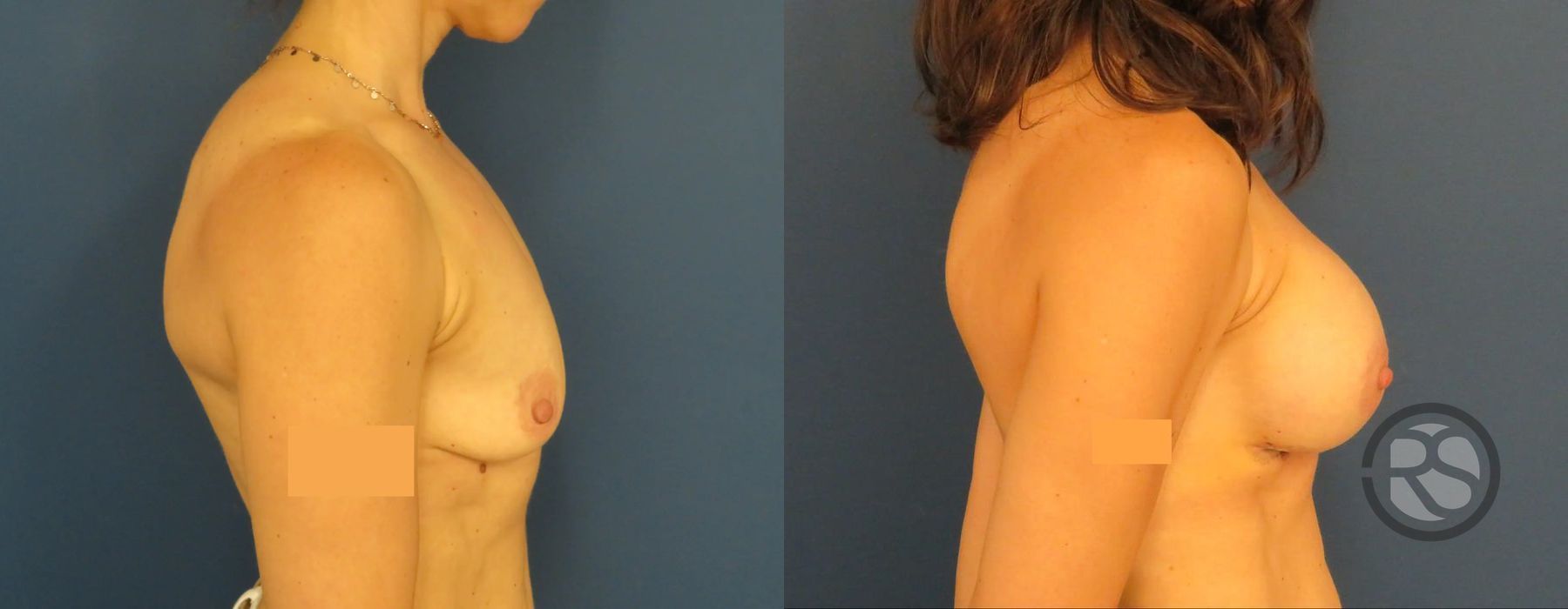 Before photo - Angle 3