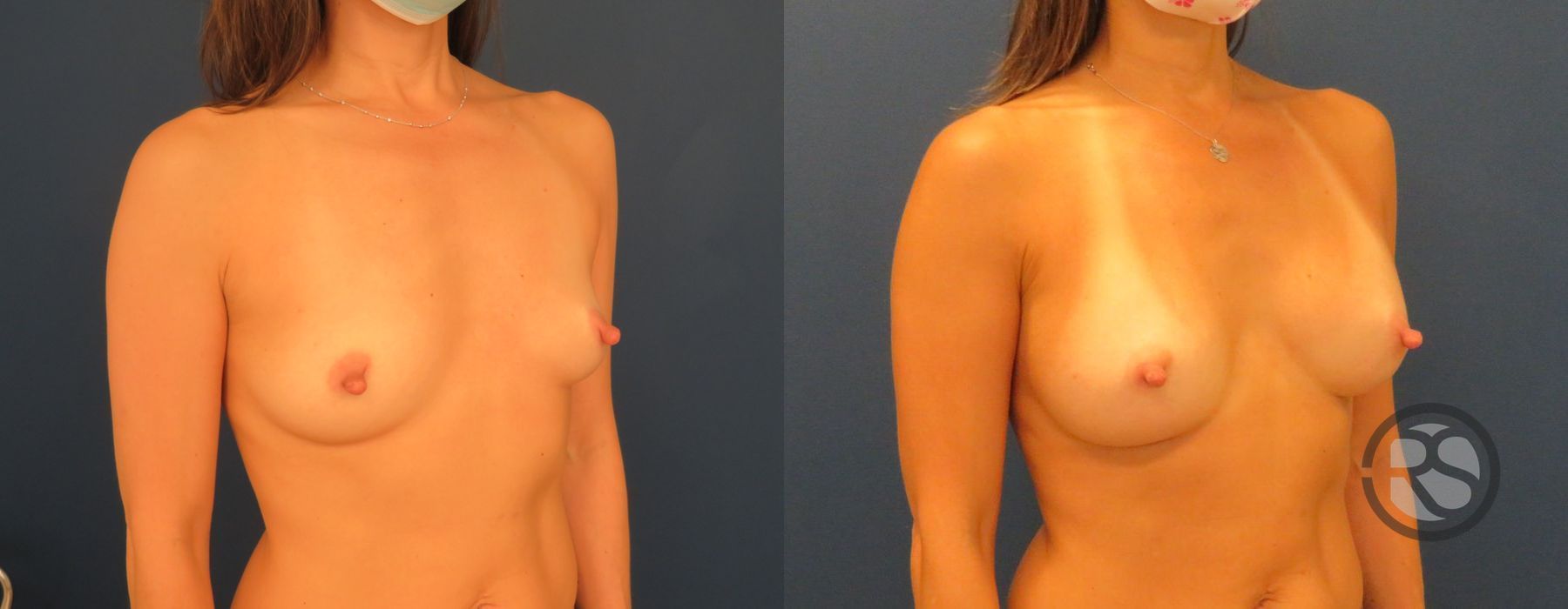 Before photo - Angle 2