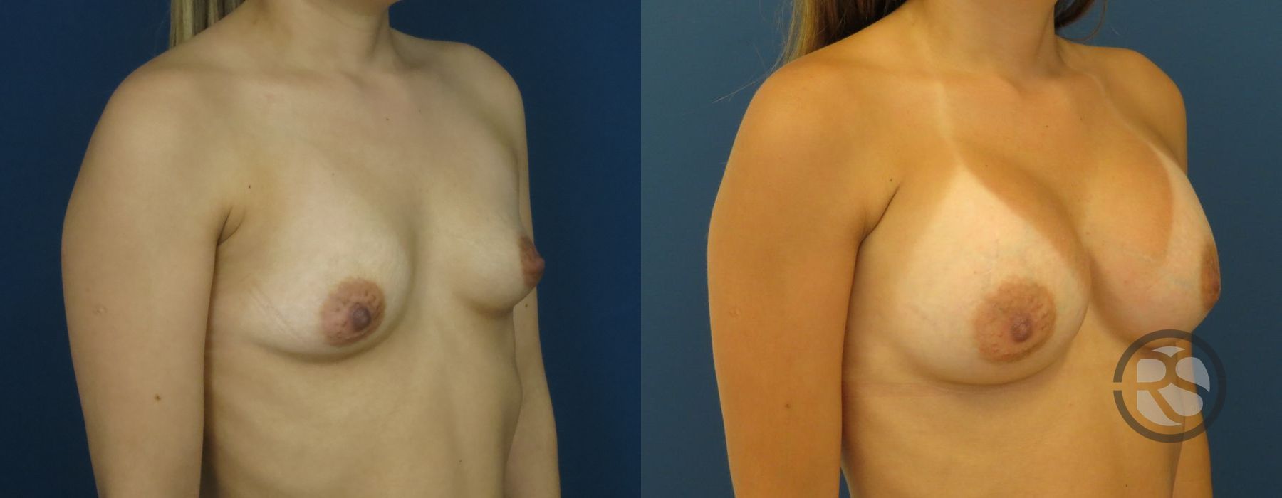 Before photo - Angle 2