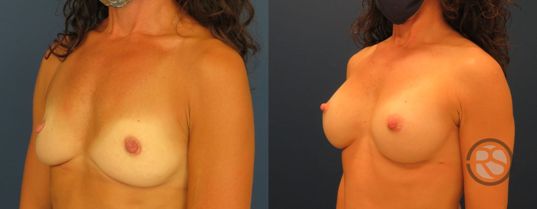 Before photo - Angle 2