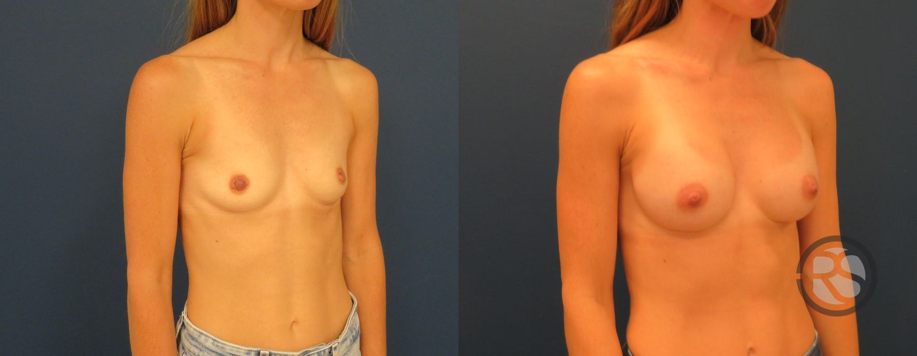 Before photo - Angle 2