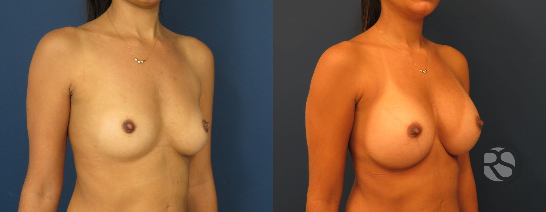 Before photo - Angle 4