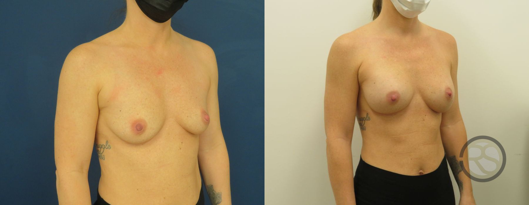 Before photo - Angle 2