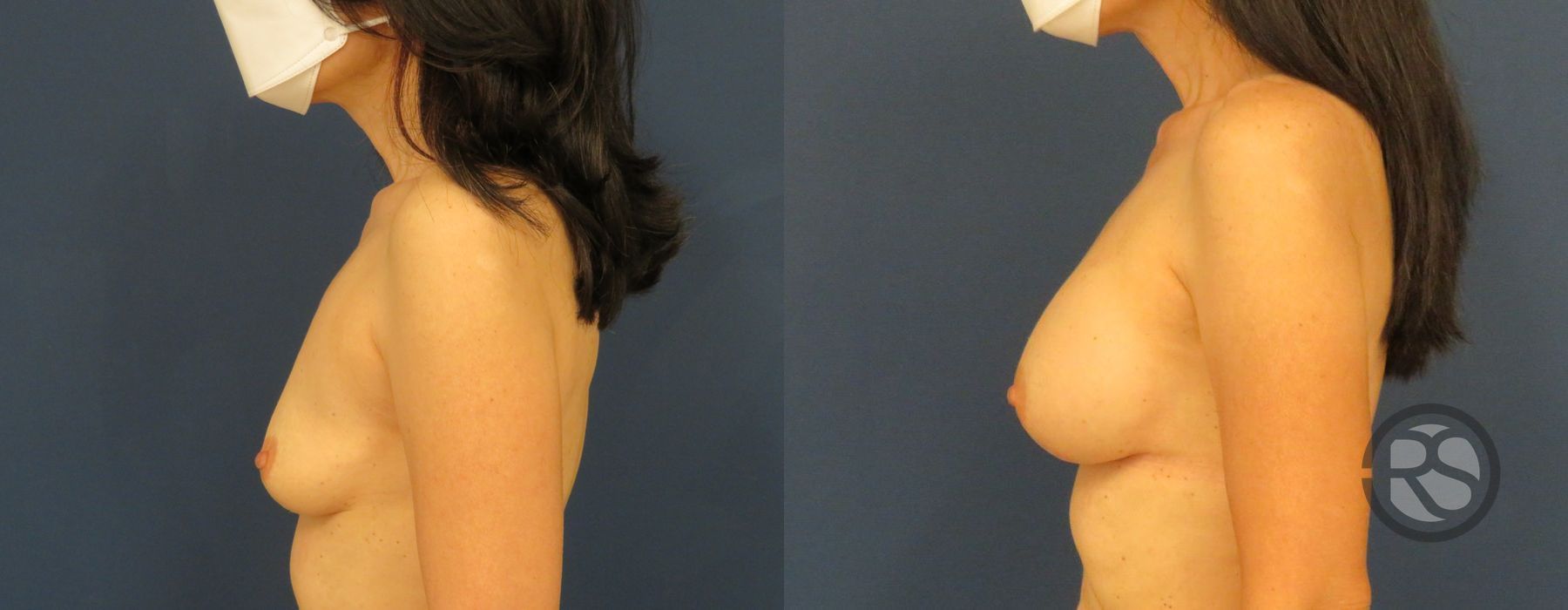 Before photo - Angle 3