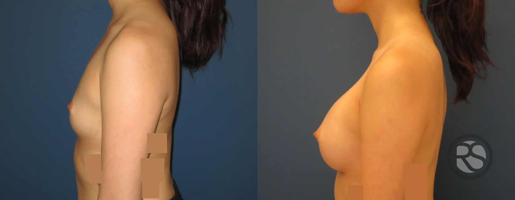 Before photo - Angle 5