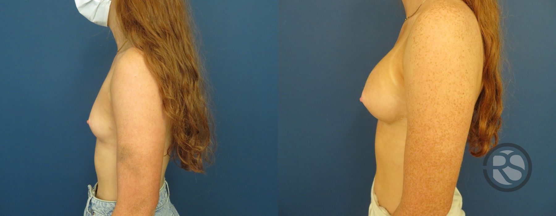 Before photo - Angle 3