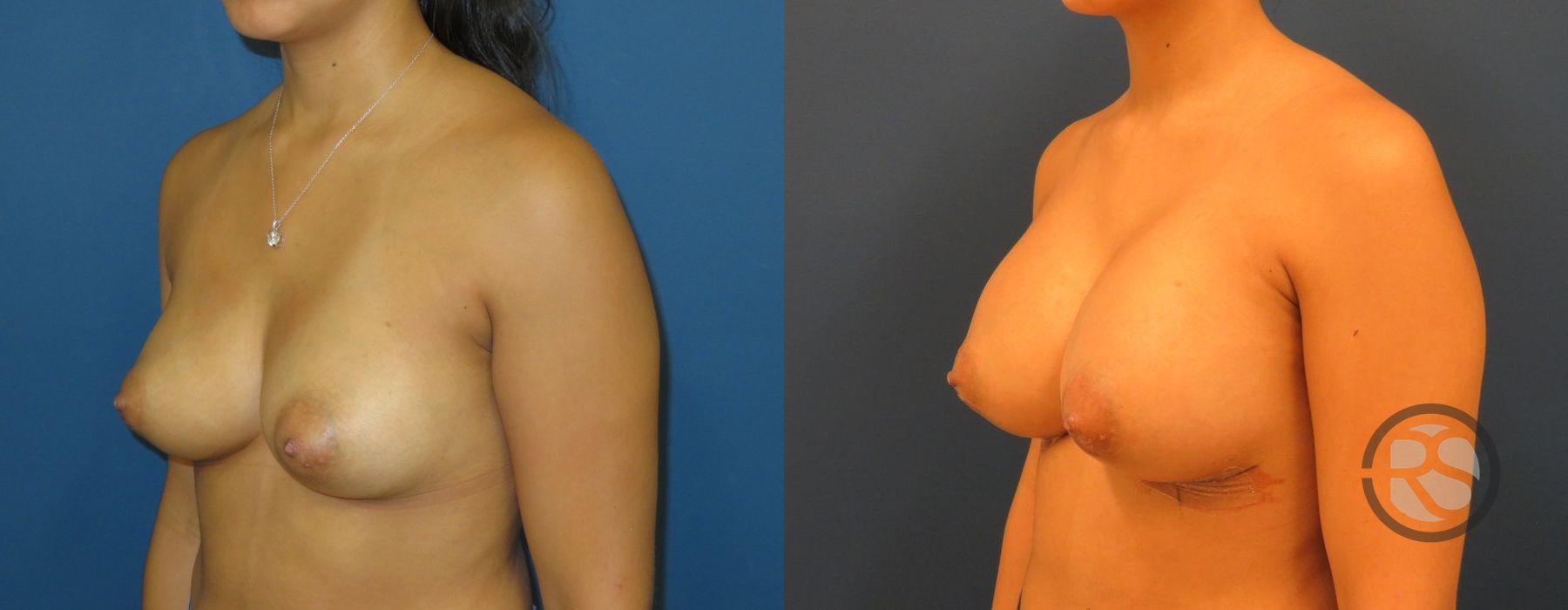 Before photo - Angle 2