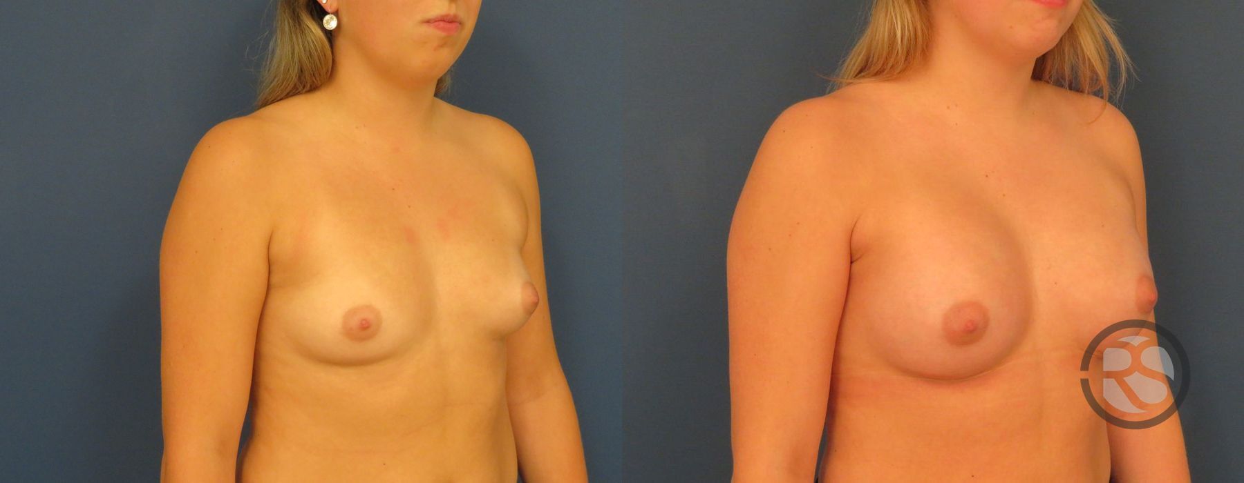 Before photo - Angle 2