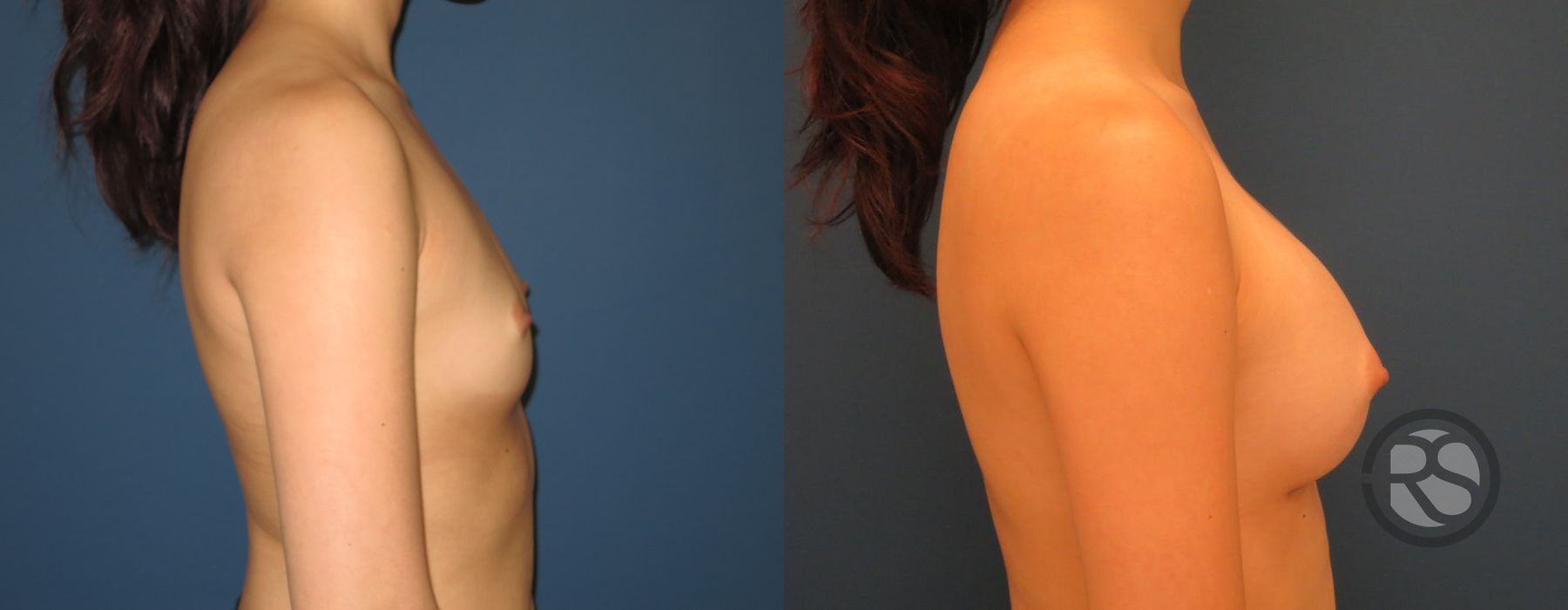 Before photo - Angle 3