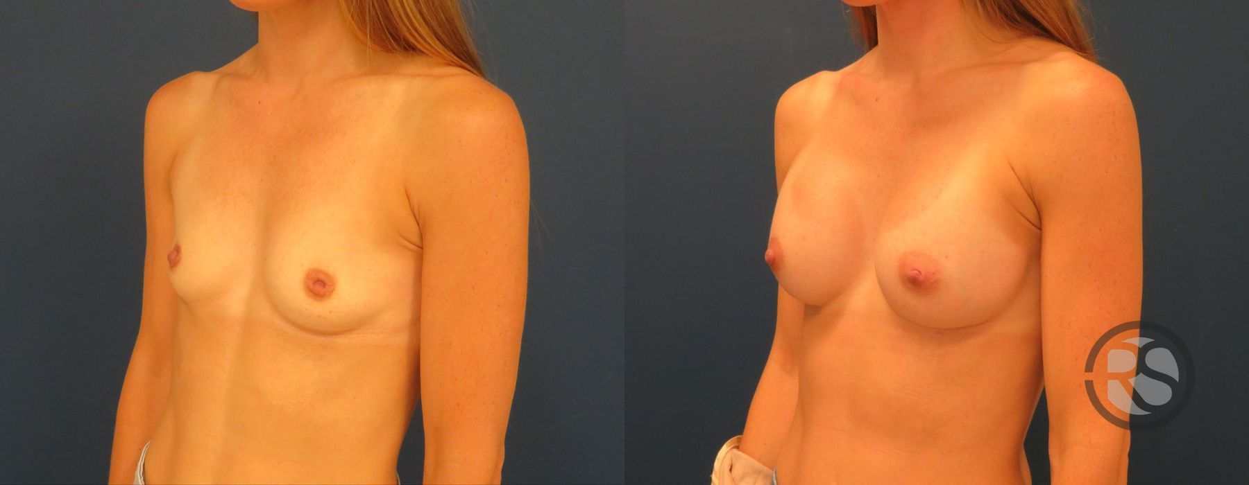 Before photo - Angle 4