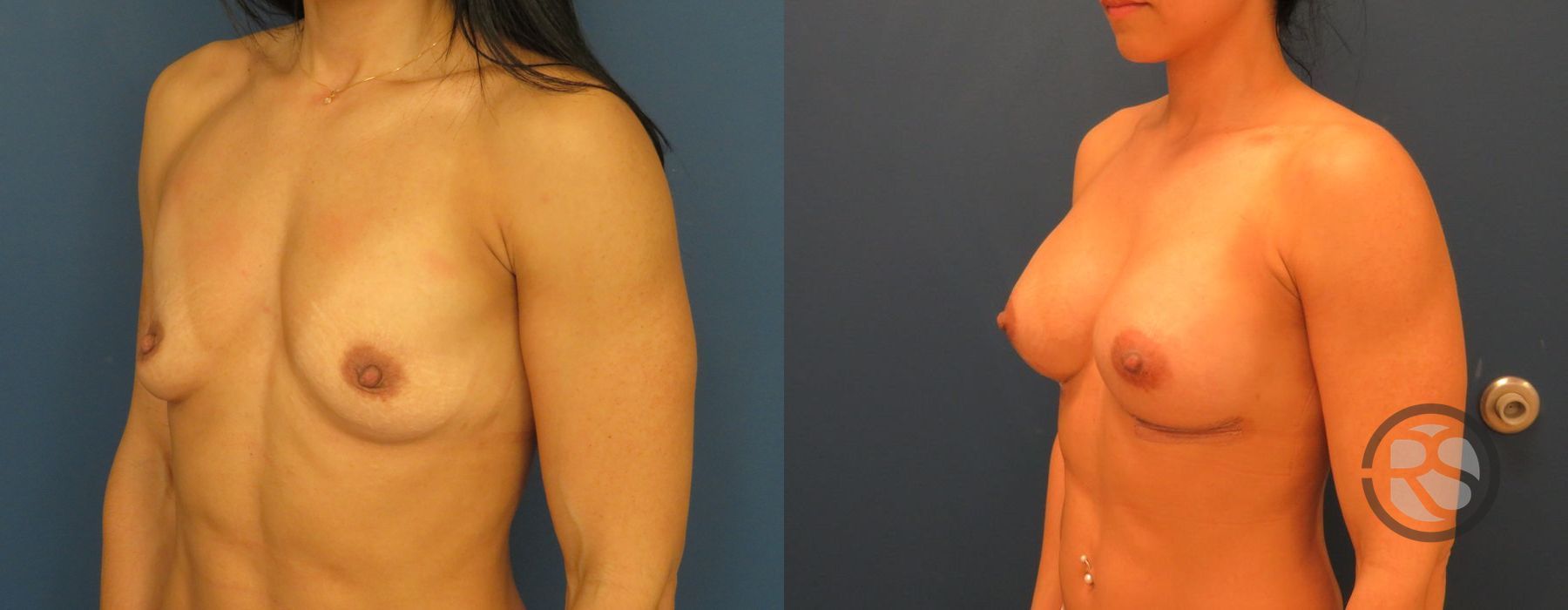 Before photo - Angle 2