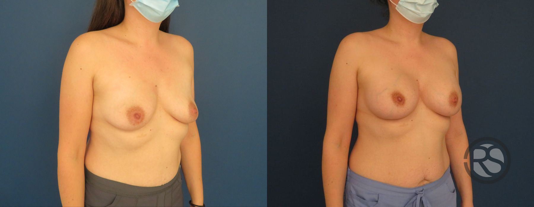 Before photo - Angle 2