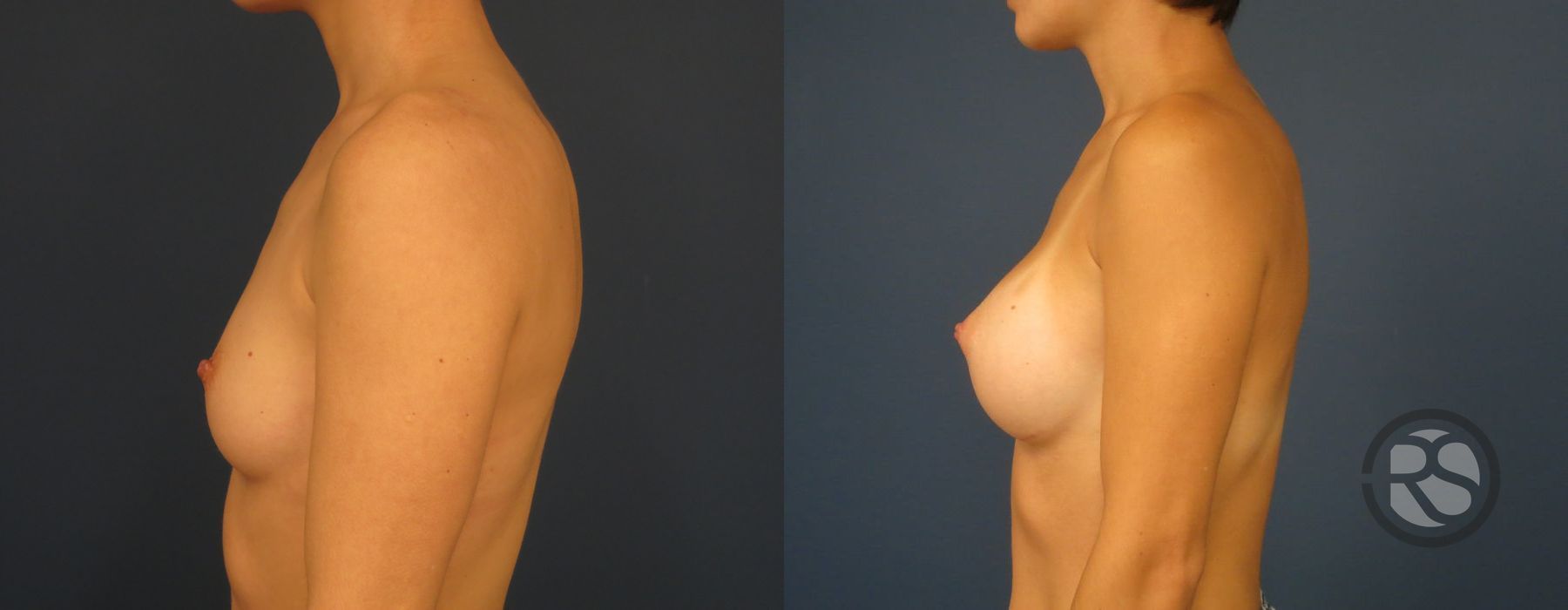 Before photo - Angle 3