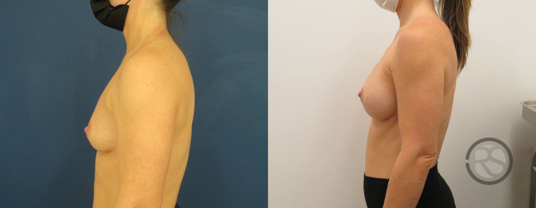 Before photo - Angle 5