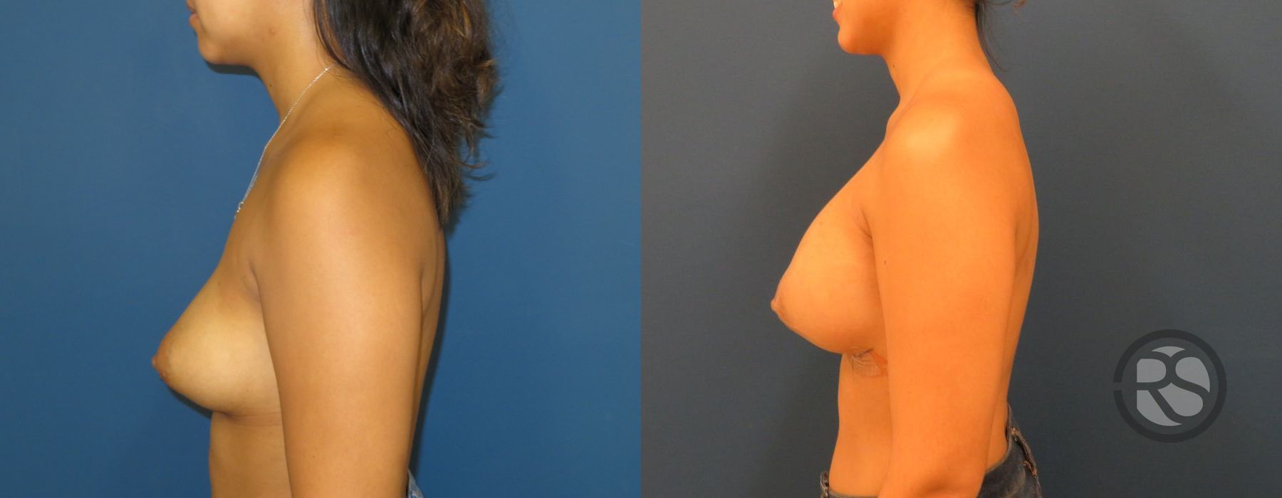 Before photo - Angle 3