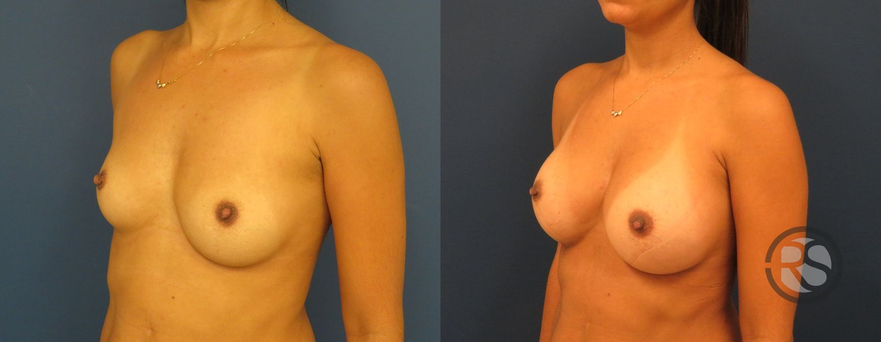 Before photo - Angle 2