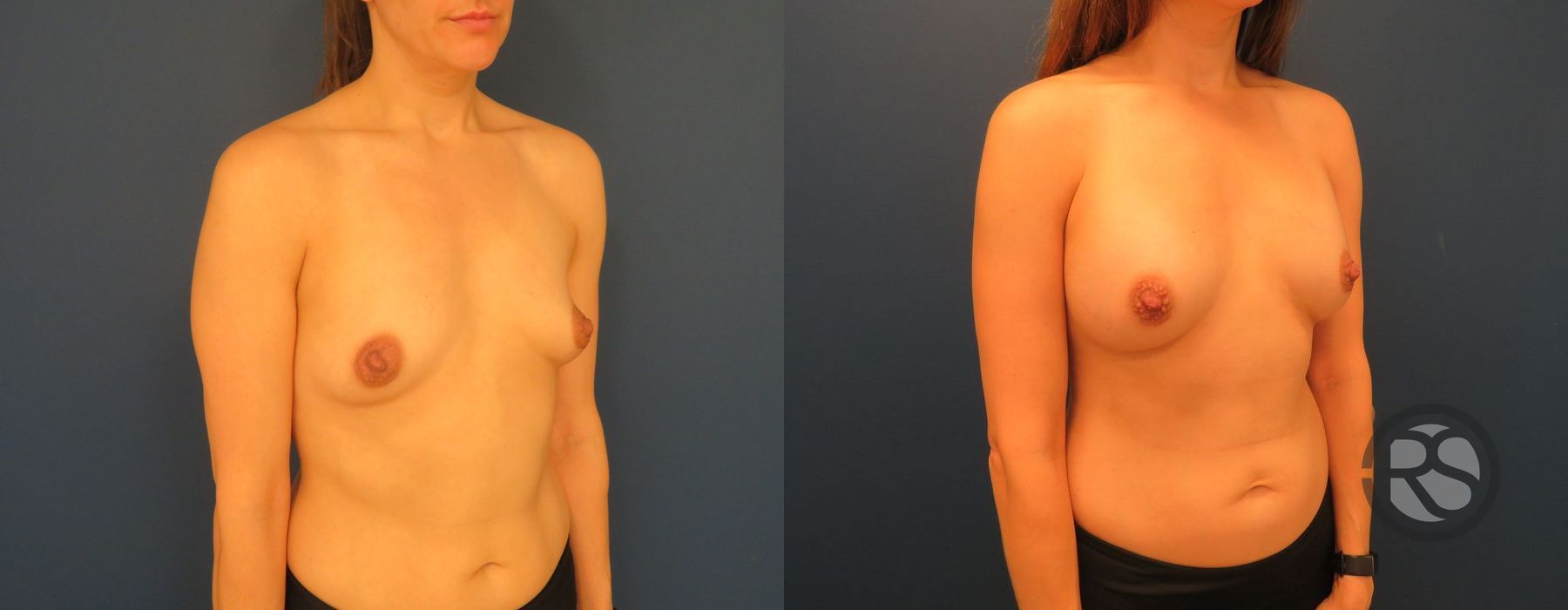 Before photo - Angle 4