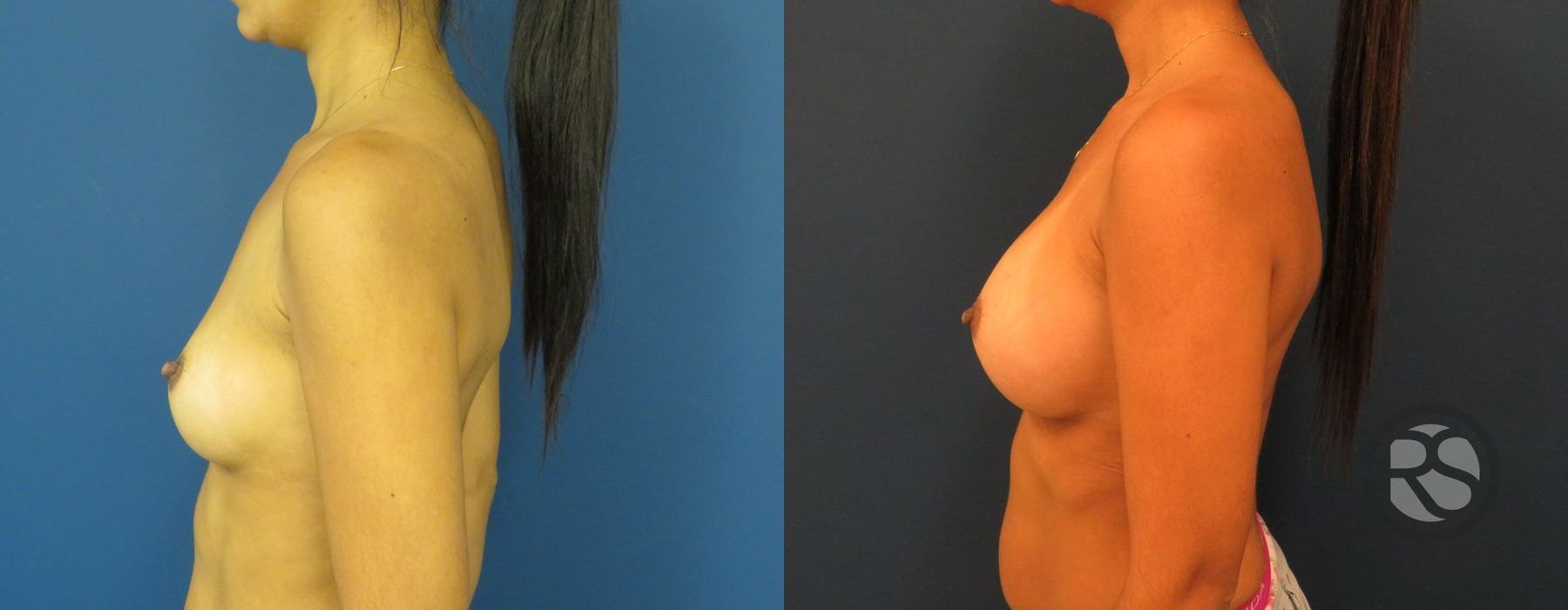 Before photo - Angle 3