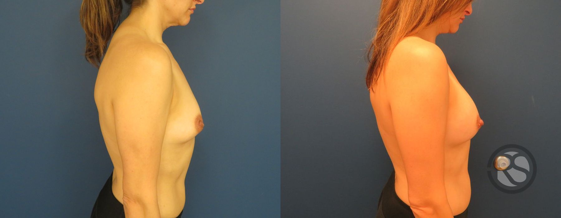 Before photo - Angle 5