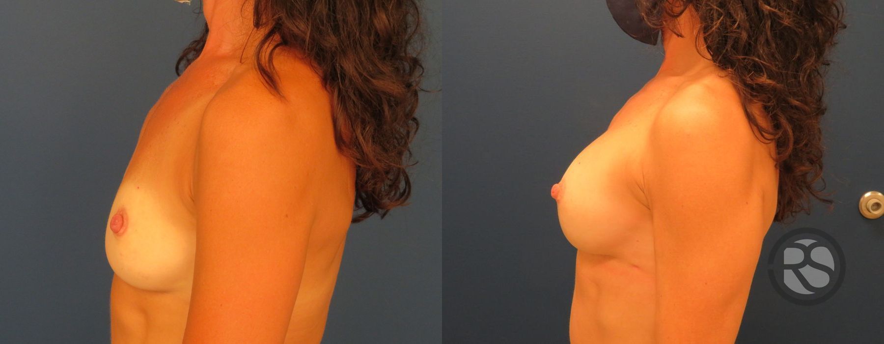 Before photo - Angle 5