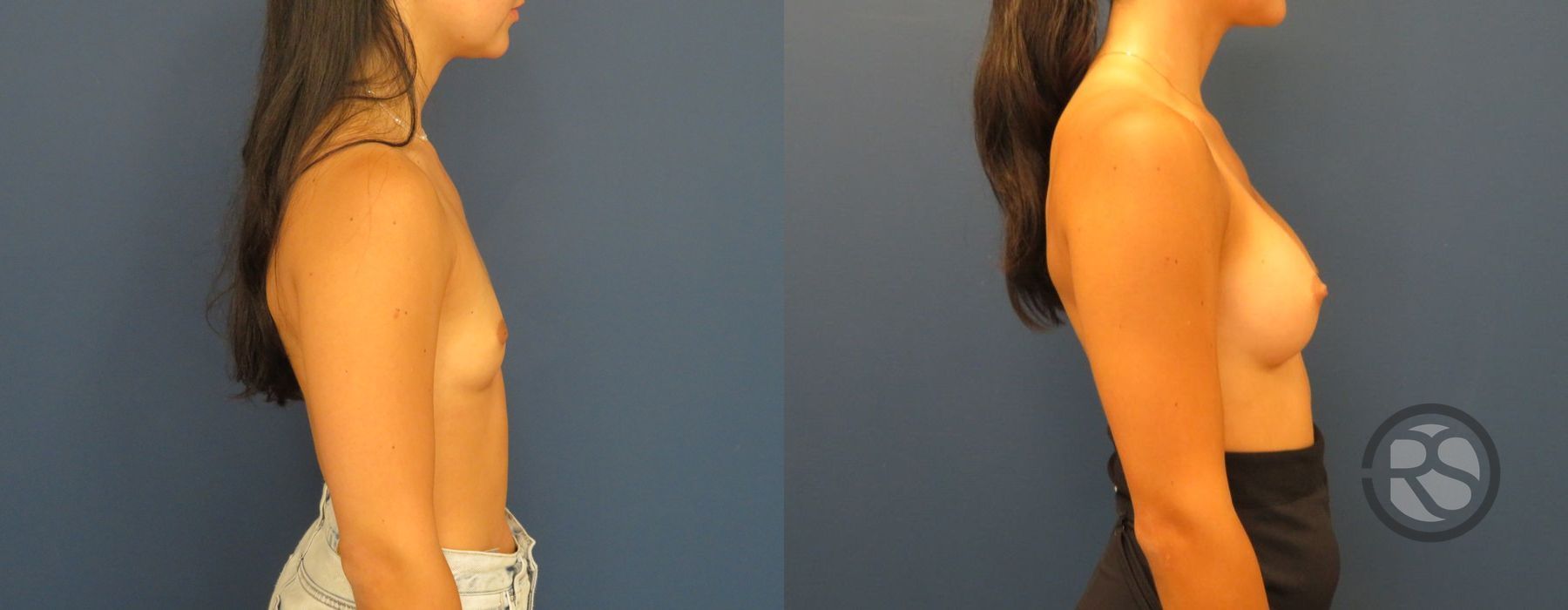 Before photo - Angle 5