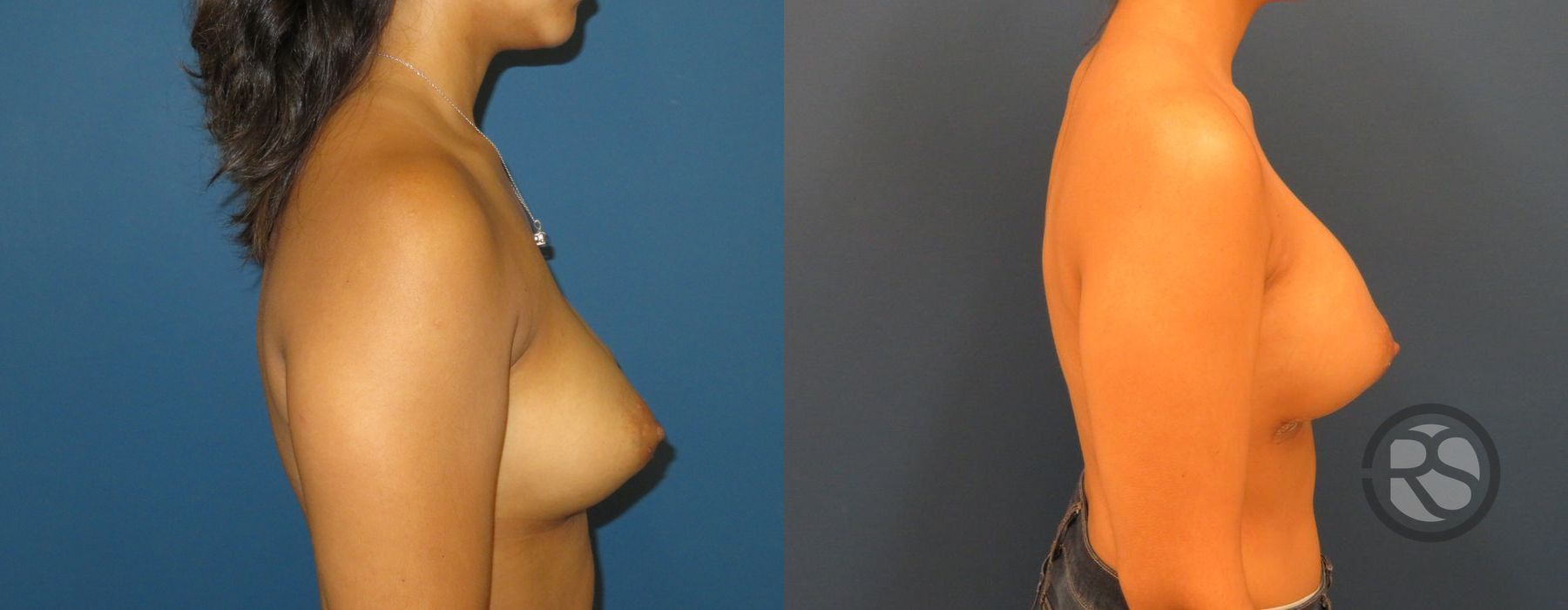 Before photo - Angle 5