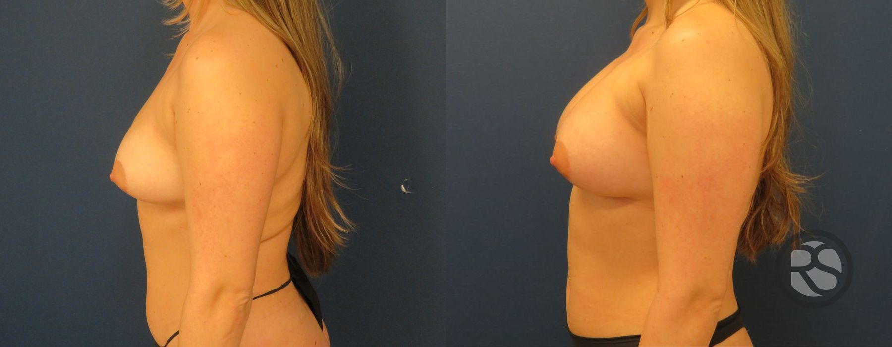 Before photo - Angle 3