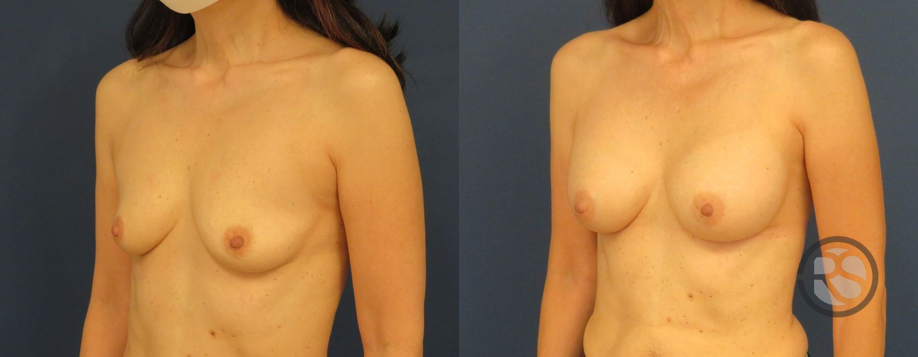 Before photo - Angle 2